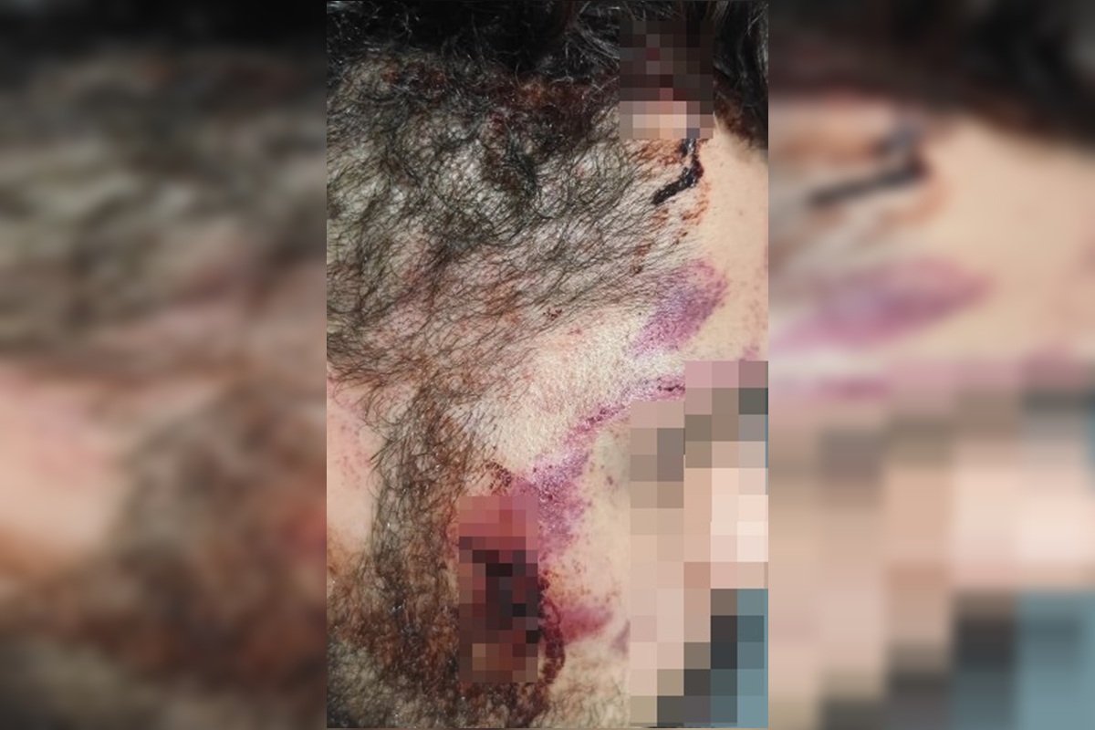 Motorista de app é espancado no DF após briga de trânsito