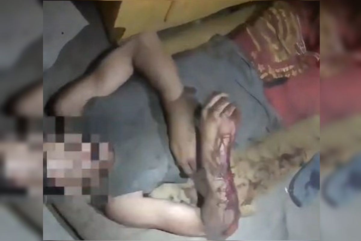 Homem desmaia após ser espancado no Entorno e é socorrido pelos bombeiros