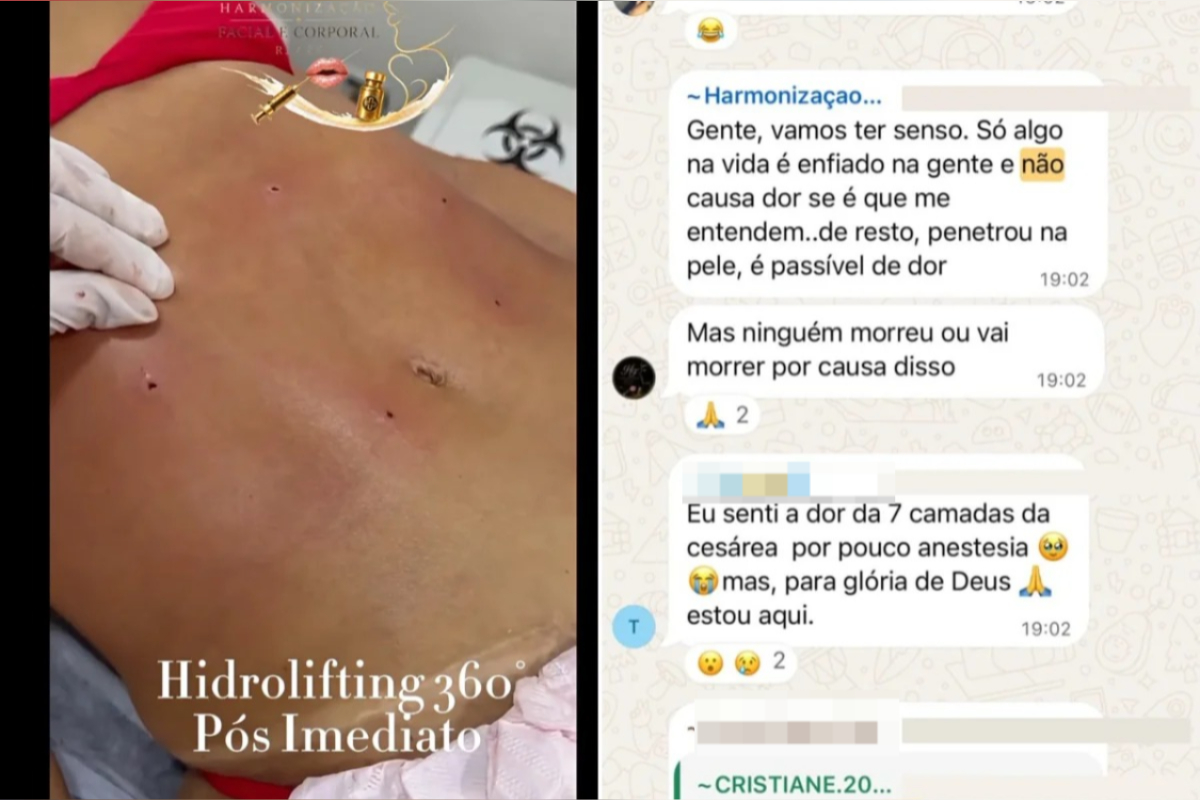 Clínica no RJ é denunciada por lipo irregular e rebate: “Ninguém morreu”