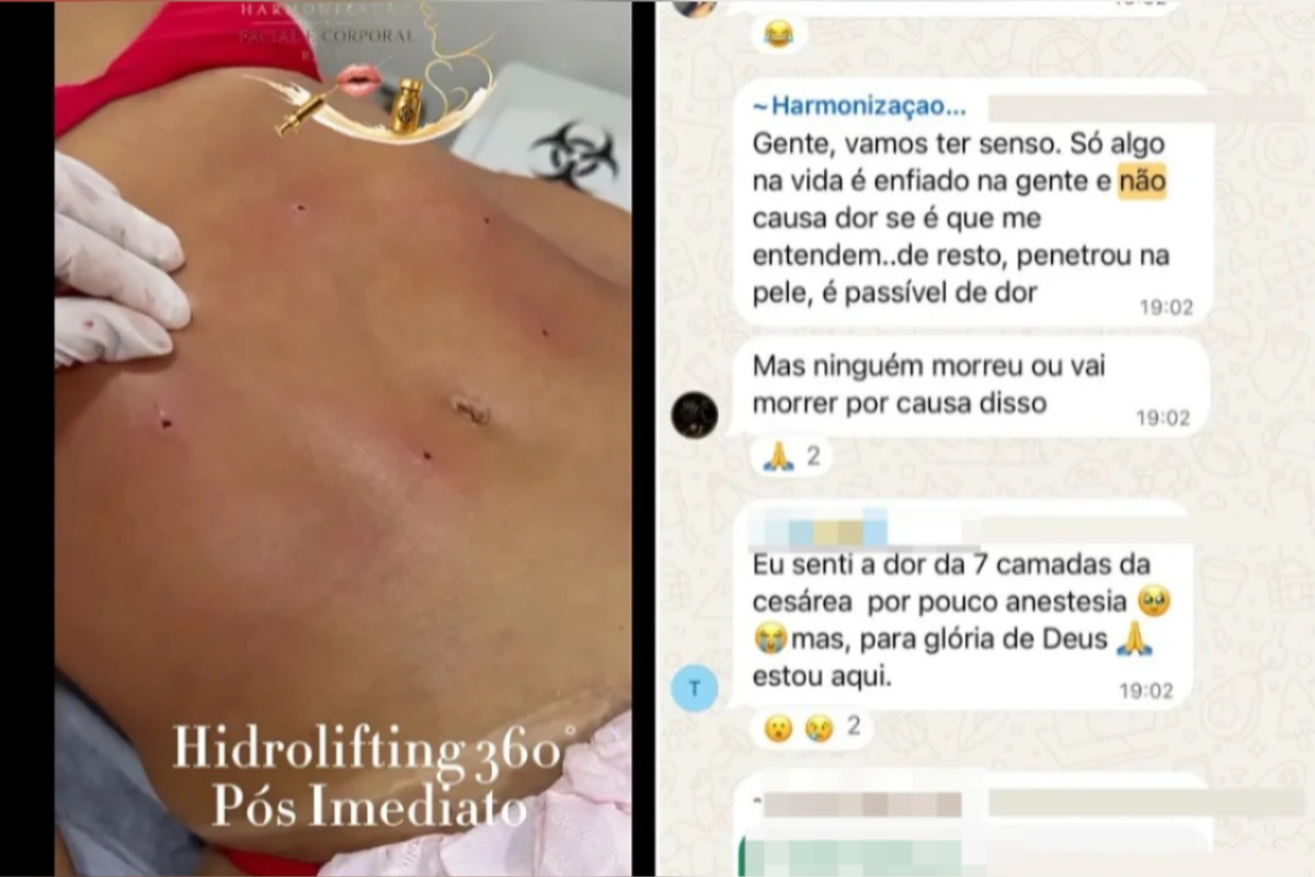 Clínica no RJ é denunciada por lipo irregular e rebate: “Ninguém morreu”