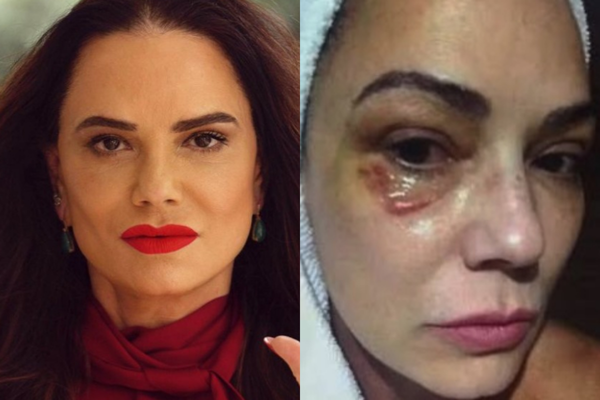 Luiza Brunet desabafa após ex ser condenado por agressões: "Muito pouco"