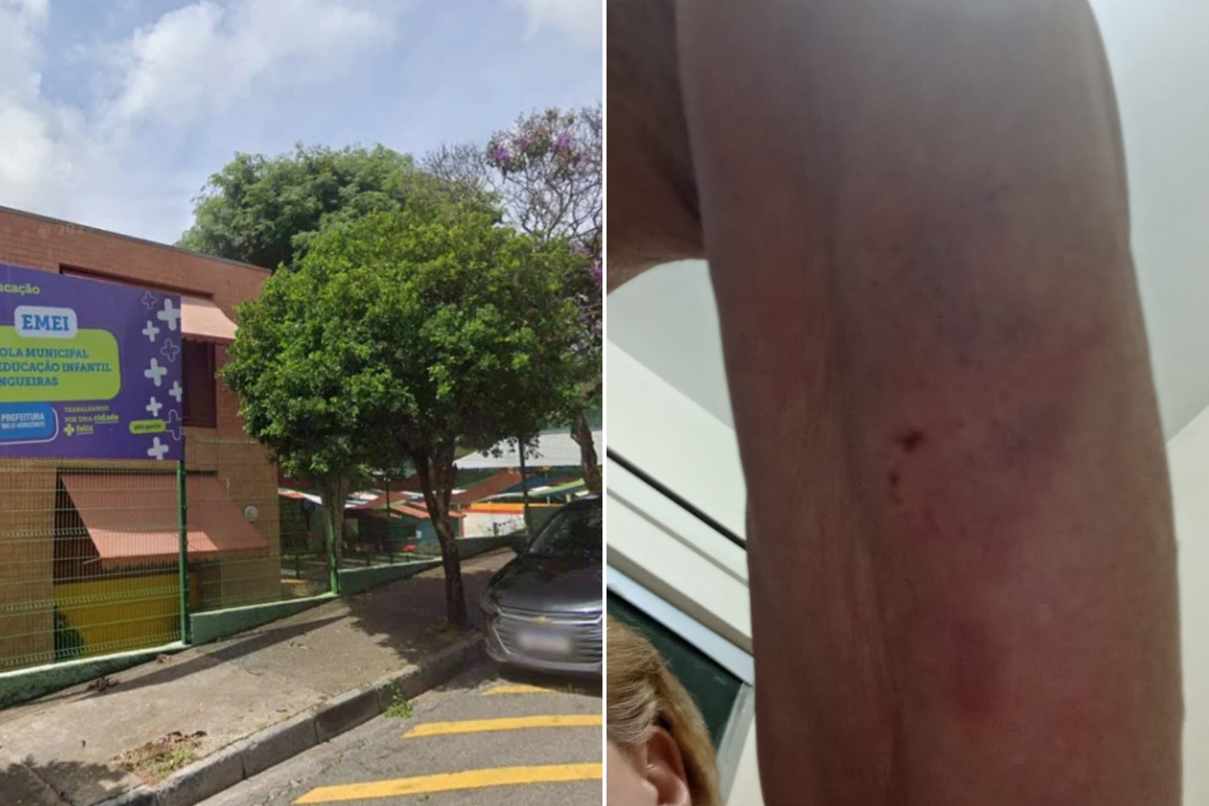 Professora é agredida por mãe de aluna em escola de BH: "Falta segurança" - Foto