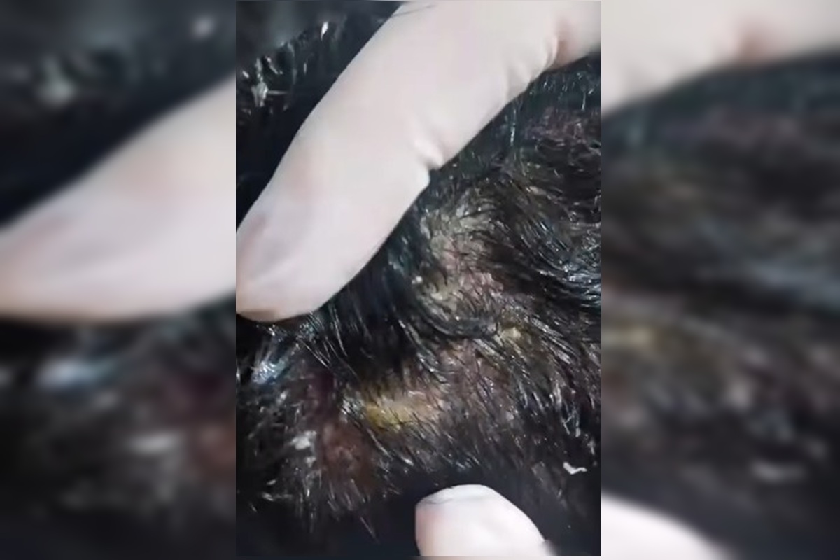 Larvas na cabeça: pais presos por maus-tratos barraram assistente social