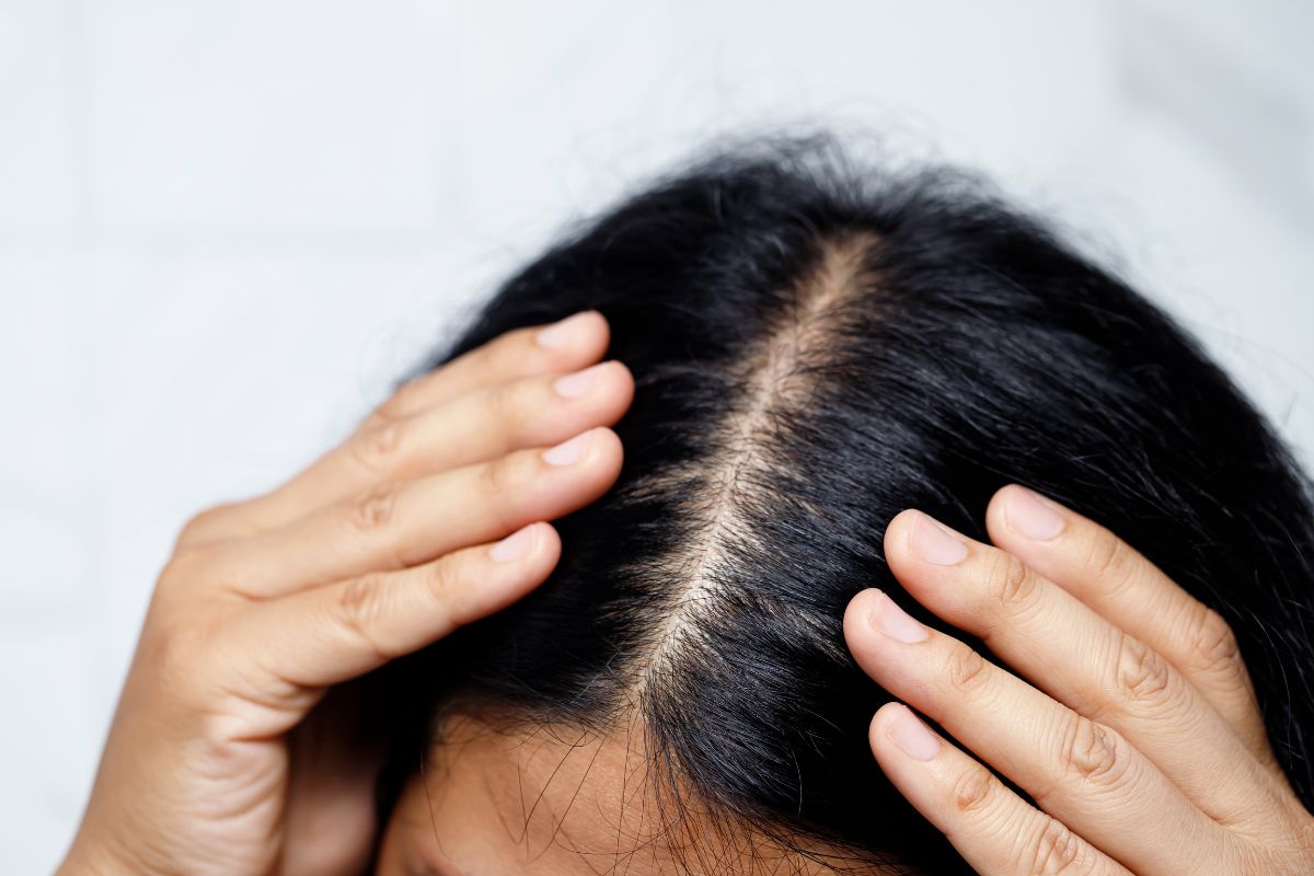 Scab hair: veja cuidados necessários para melhorar a textura capilar