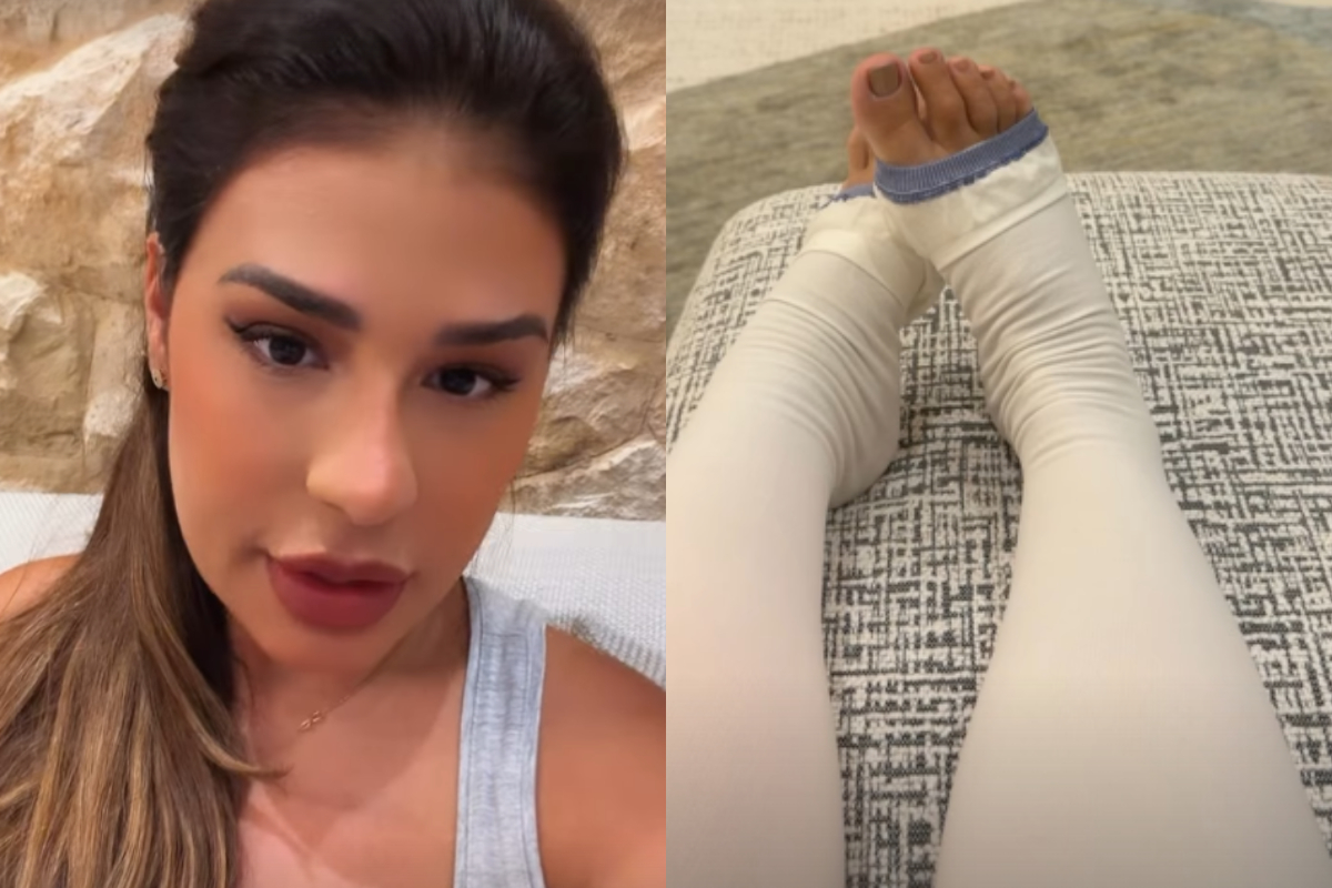 Simone Mendes desabafa após cirurgia para retirar excesso de pele: "Sonho"