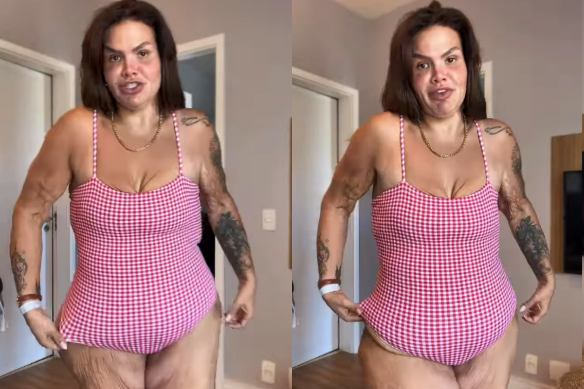 Thais Carla sobre excesso de pele após perder 120 kg: “Não deixo de viver”