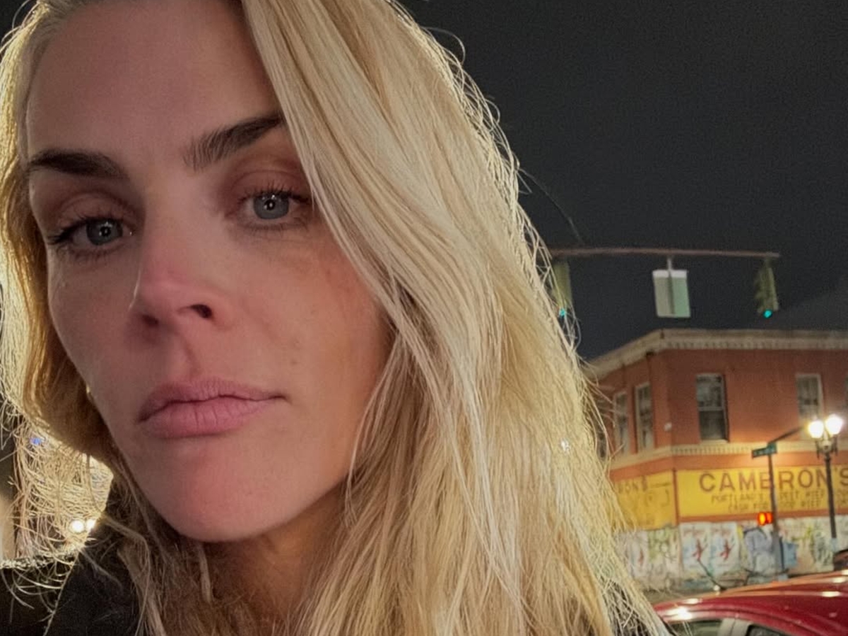 Atriz de As Branquelas revela diagnóstico de tumor cerebral e cirurgias